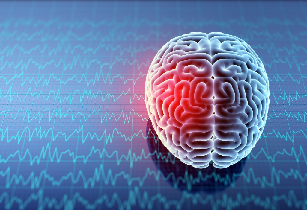 Recognizing Concussion Signs After a Car Crash