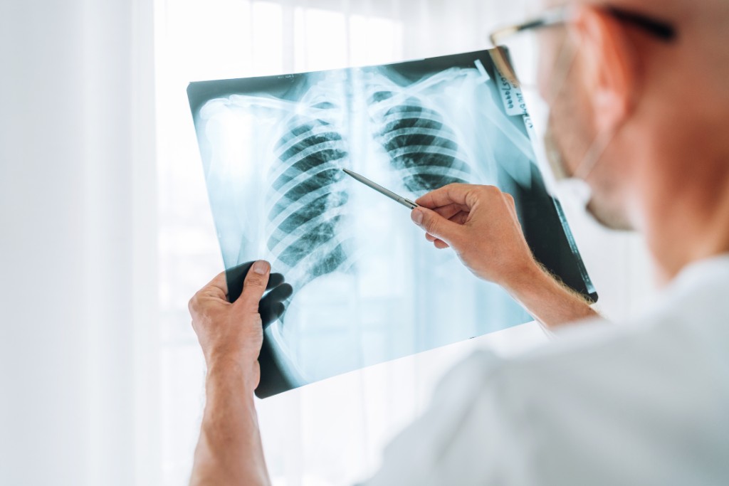 Factors Considered When Determining Catastrophic Impairment