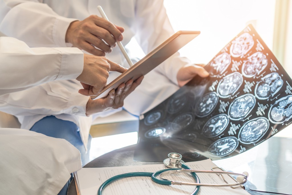 Neurofatigue After a Concussion